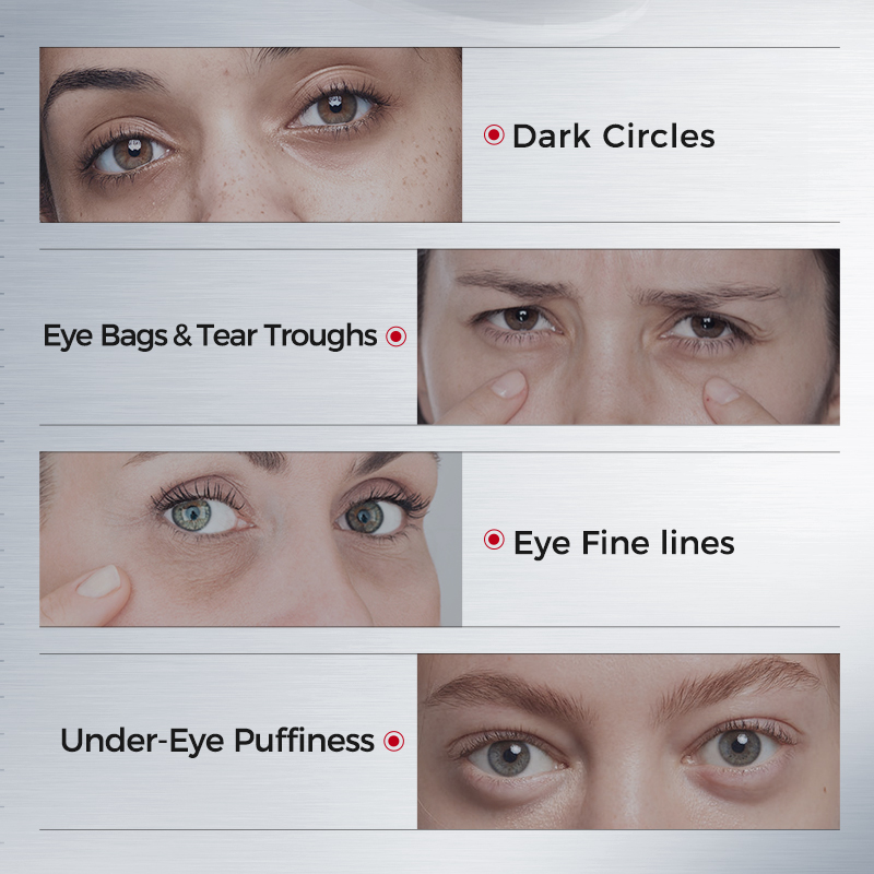 Eye Patches for Dark Circles – - Collagen Eye Patch ulasan dan harga