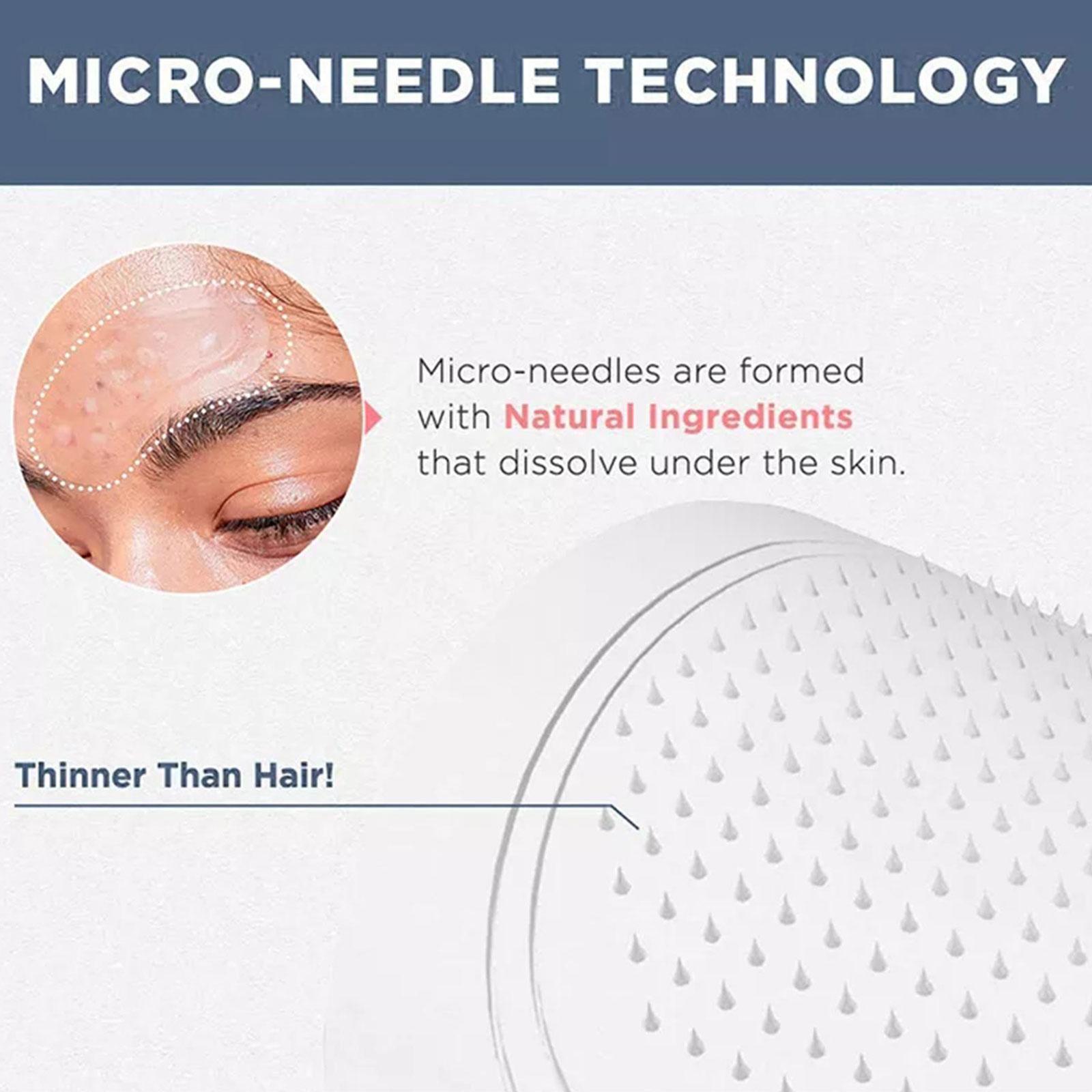 0.2mm Micro-needle Eye Patch M - Collagen Eye Patch ulasan dan harga