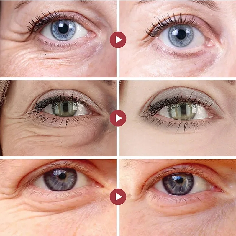 Wrinkle Remove Eyes Patches Fi - Collagen Eye Patch ulasan dan harga